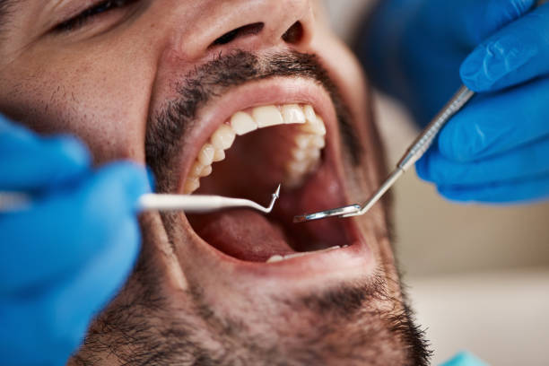 Best Emergency Cosmetic Dentistry in Maggie Valley, NC